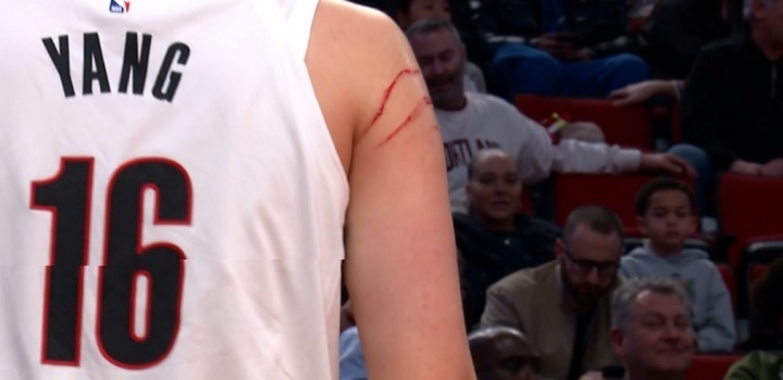 杨瀚森手臂血痕清晰可见